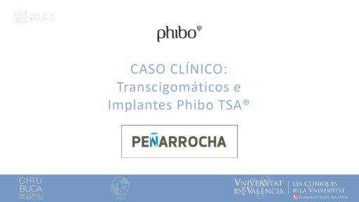 Transcigomáticos.Implantes Phibo_page-0001